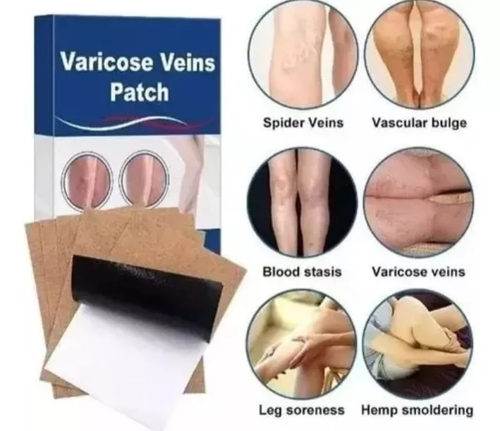 Miniatura 3 de Parches Alivia Varices Vena Varicosa
