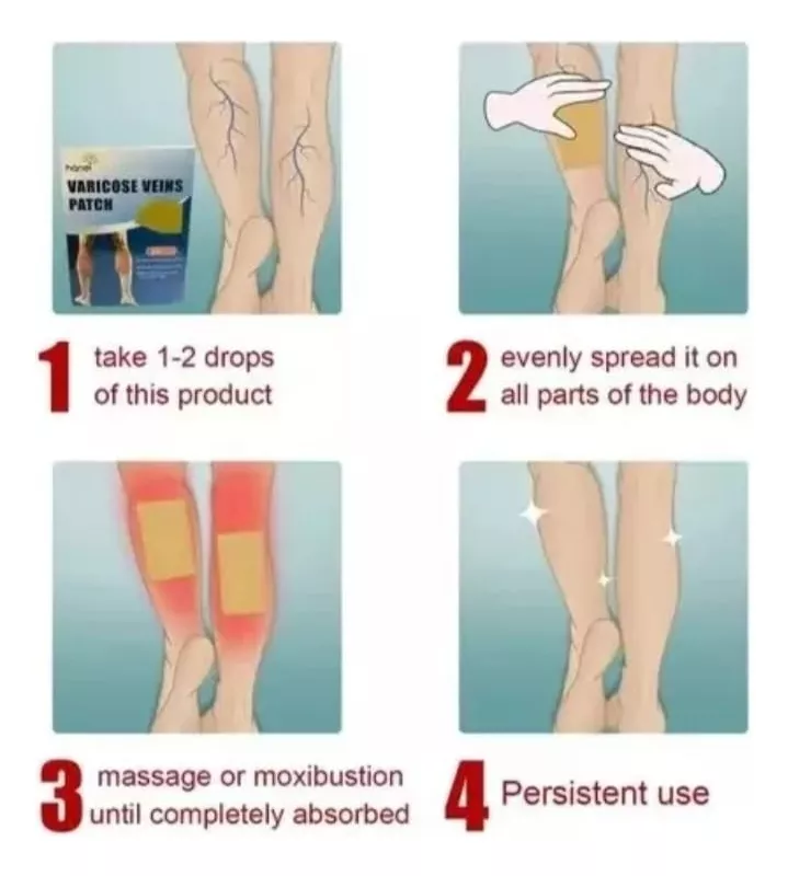 Miniatura 5 de Parches Alivia Varices Vena Varicosa
