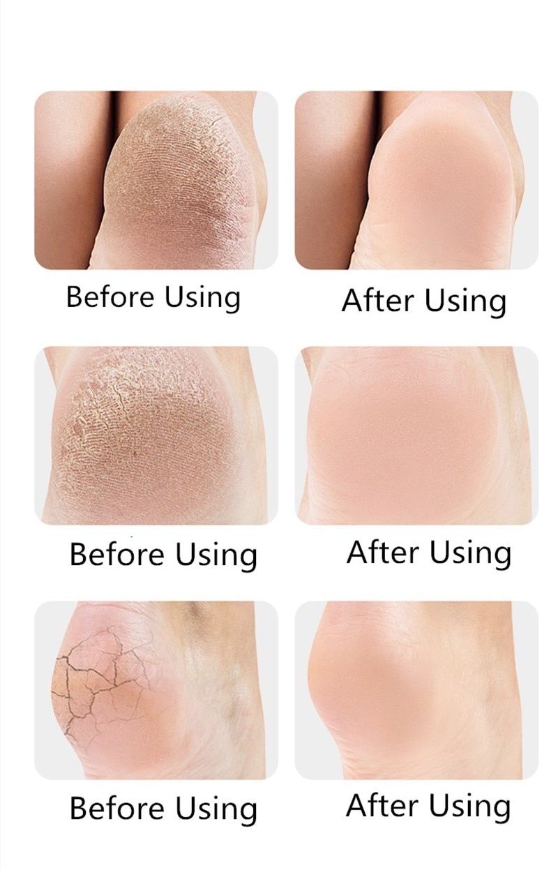 Miniatura 2 de PROTECTOR DE TALON