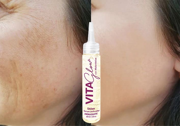 SERUM ACLARANTE PIEL