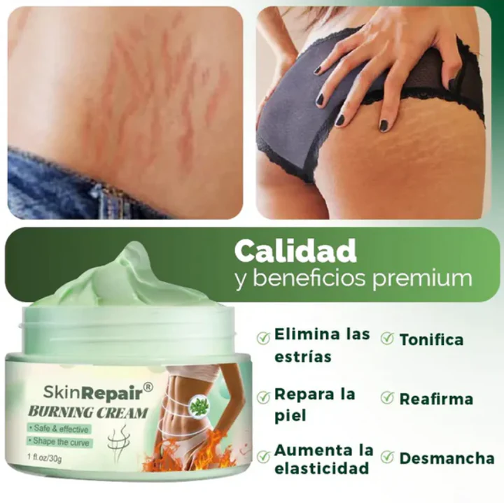 Belleza