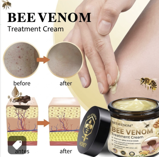 Bee Venom