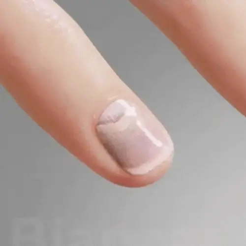 2ReviNail®REPARACION DE UÑAS