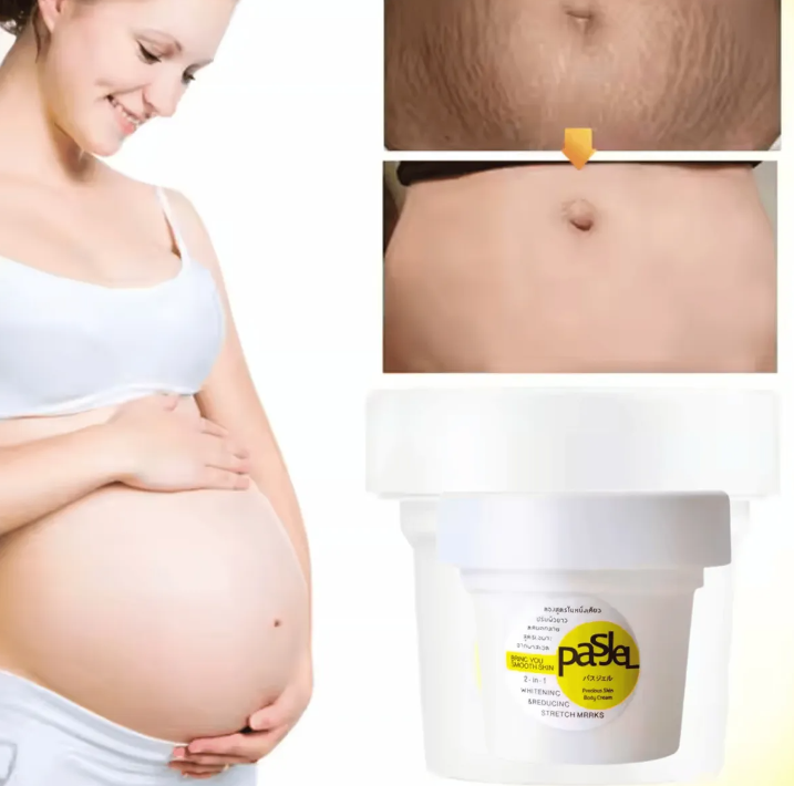 Crema Anti Estrías Pasjel: Piel Renovada y Sin Marcas