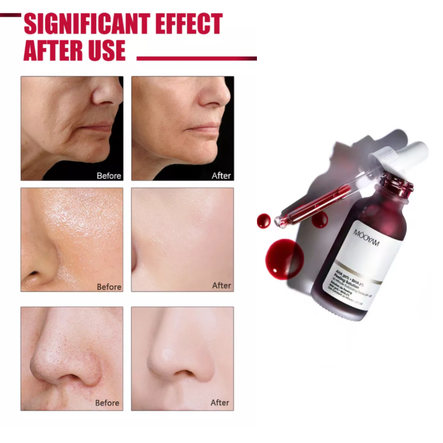 Sérum Peeling AHA 30% + BHA 2%: Piel Renovada y Radiante