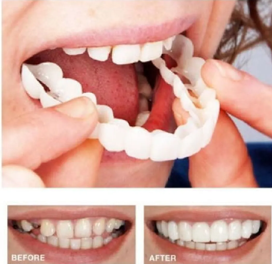 Dúo Carillas Dentales Dientes Postizos