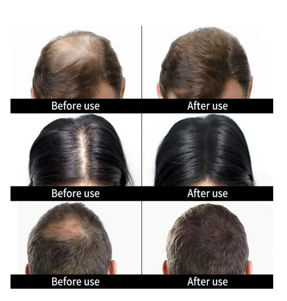 Fibra Capilar para engrosar el cabello