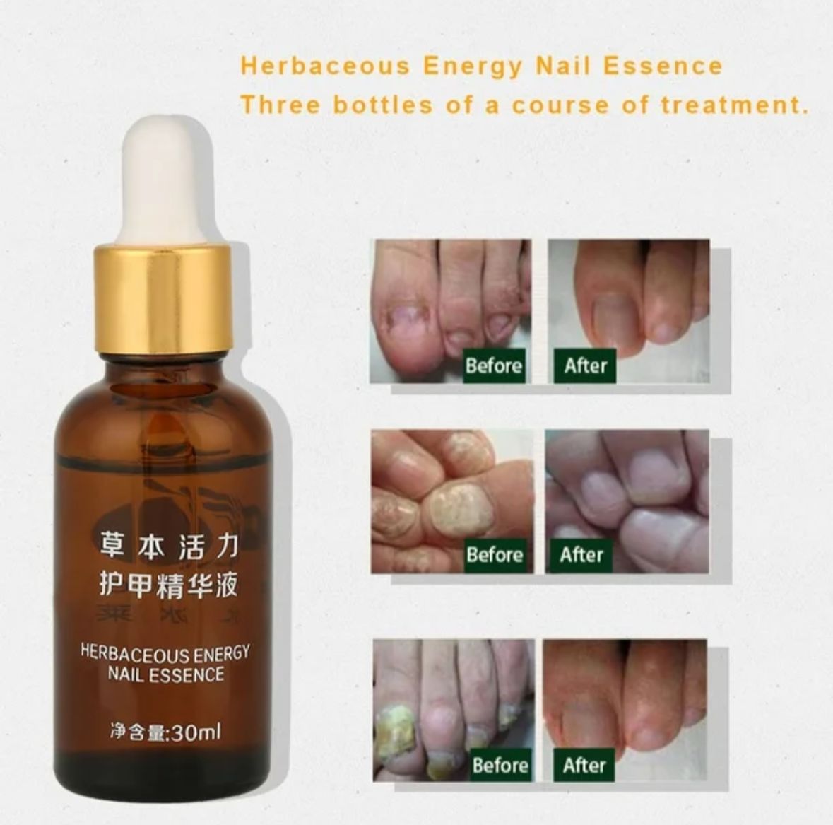 ESENCIA PARA EL TRATAMIENTO DE UÑAS 30ML